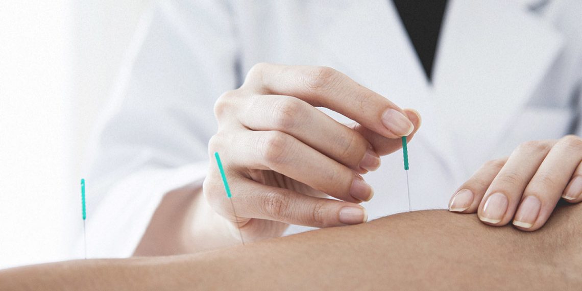 top acupuncture services